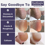 Footlogix Ultimate "At Home" Foot Care Combo 100ml