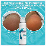 Footlogix DD Cream Mousse Formula 125ml