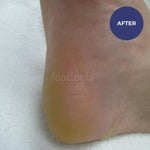 Footlogix Daily Maintenance Formula 125ml