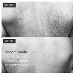 Back & Body Hair Removal - The Silverback Kit
