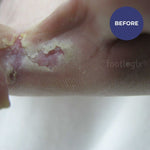 Footlogix Peeling Skin Formula 125ml