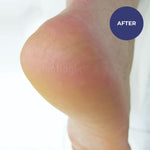 Footlogix Rough Skin Formula 125ml