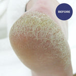 Footlogix Rough Skin Formula 125ml