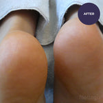 Footlogix Very Dry Skin Formula 125ml