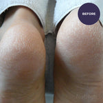 Footlogix Very Dry Skin Formula 125ml