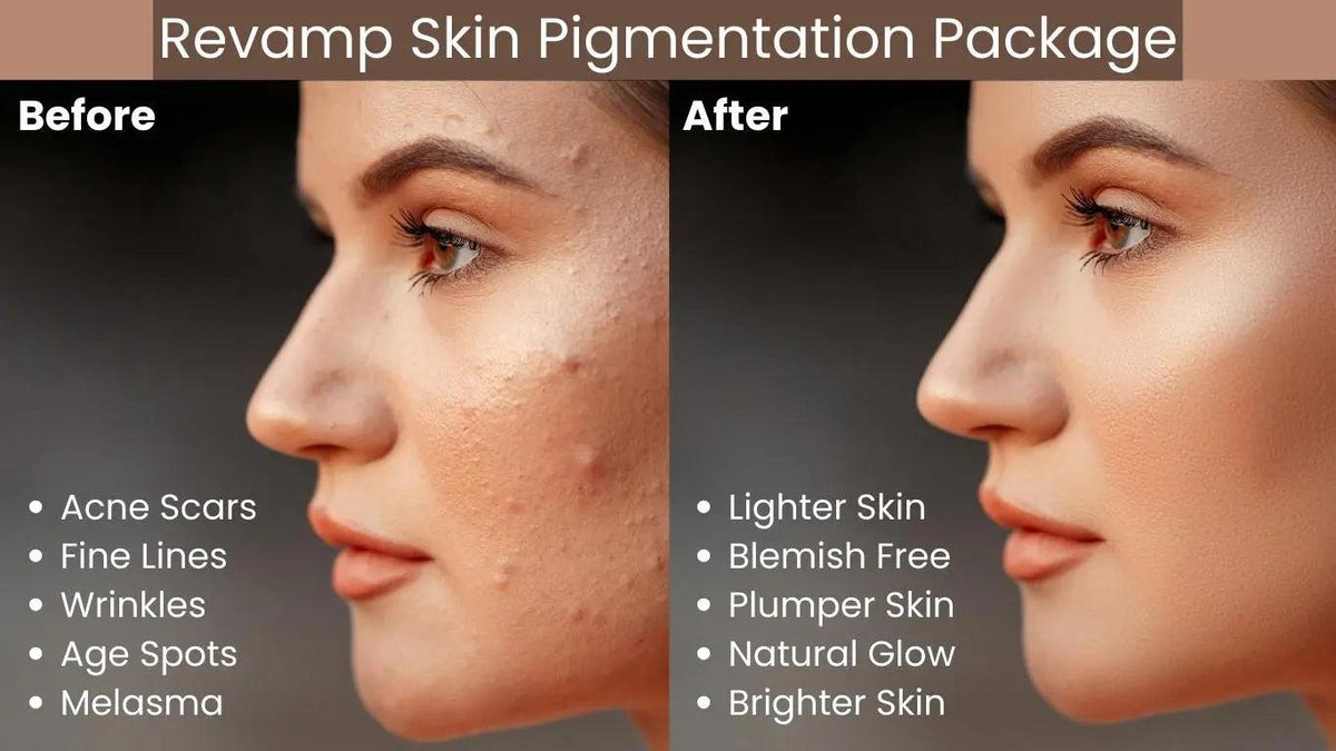 Ammuri Skincare Pigmentation Skincare Gift Set