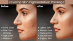 Ammuri Skincare Pigmentation Skincare Gift Set