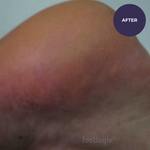 Footlogix DD Cream Mousse Formula 125ml