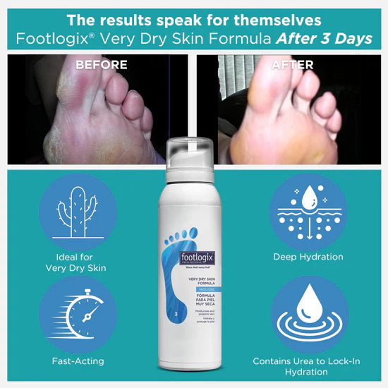 Footlogix Very Dry Skin Formula 125ml