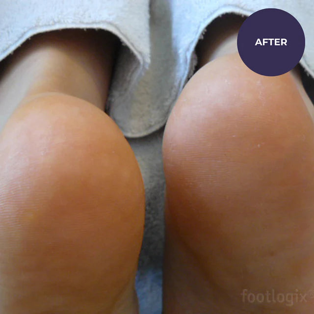 Footlogix Very Dry Skin Formula 125ml