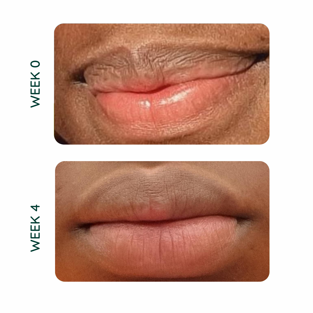 Tenol Exfoliating Lip Gel - For Anti-Ageing and Repair