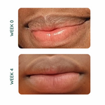 Tenol Exfoliating Lip Gel - For Anti-Ageing and Repair